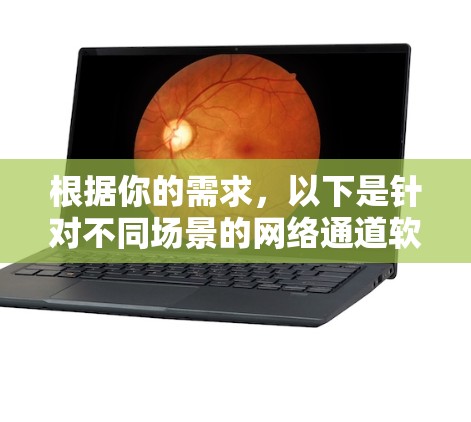 根据你的需求，以下是针对不同场景的网络通道软件推荐